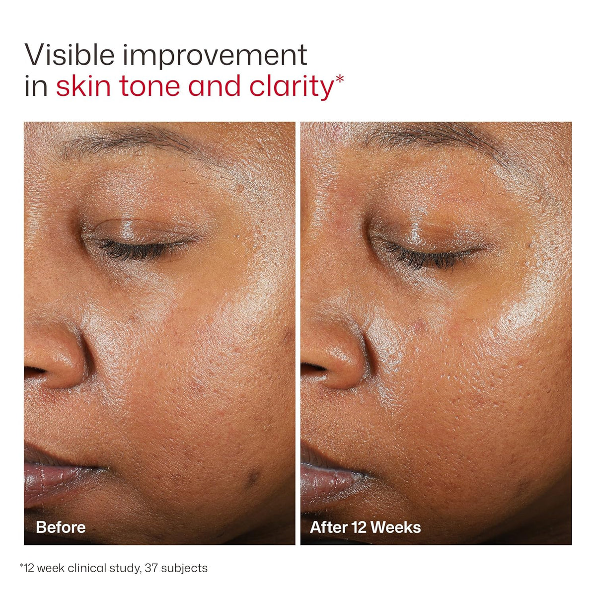 Eltamd UV Clear Face Sunscreen with Zinc Oxide, Oil-Free, SPF 46 and SPF 50